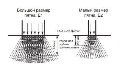 лазерная эпиляция