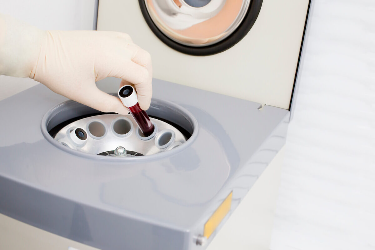 Центрифуга для плазмолифтинга