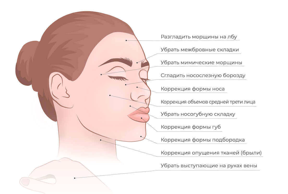 виды контурной пластики