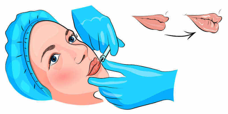 Процесс увеличения губ